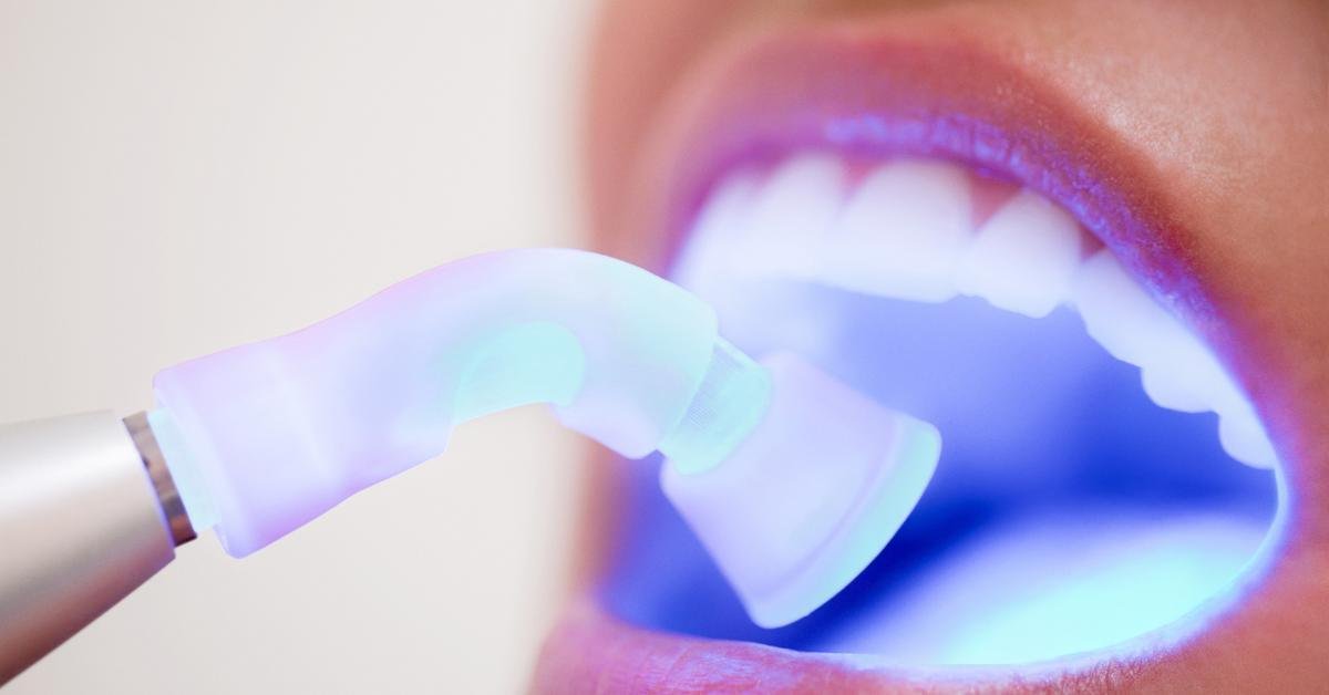 Laser Treatment in Tillsonburg