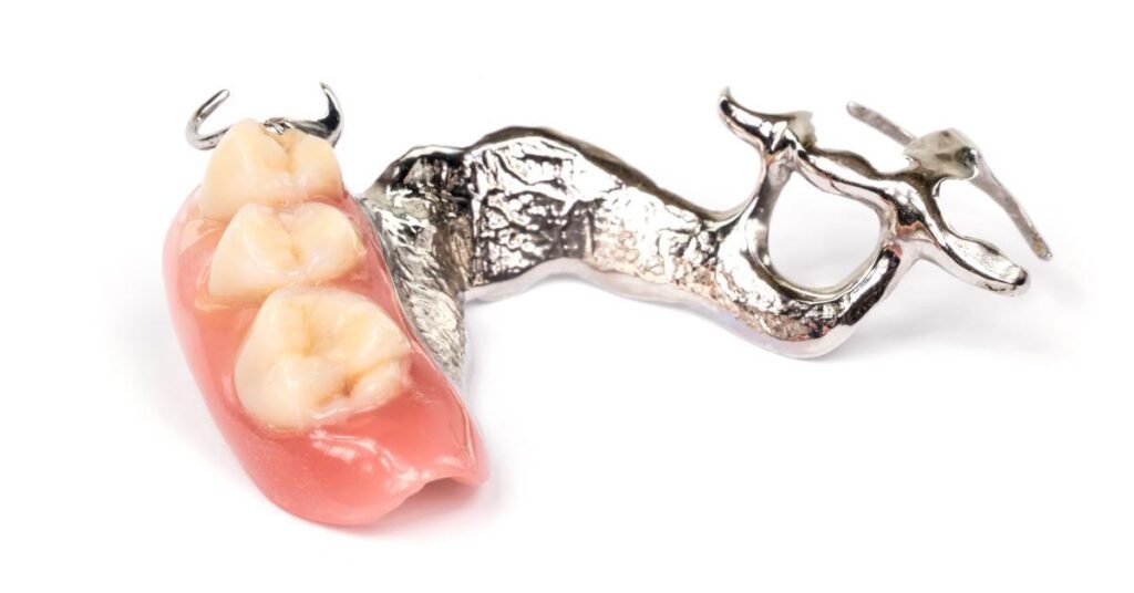 how long do partial dentures last
