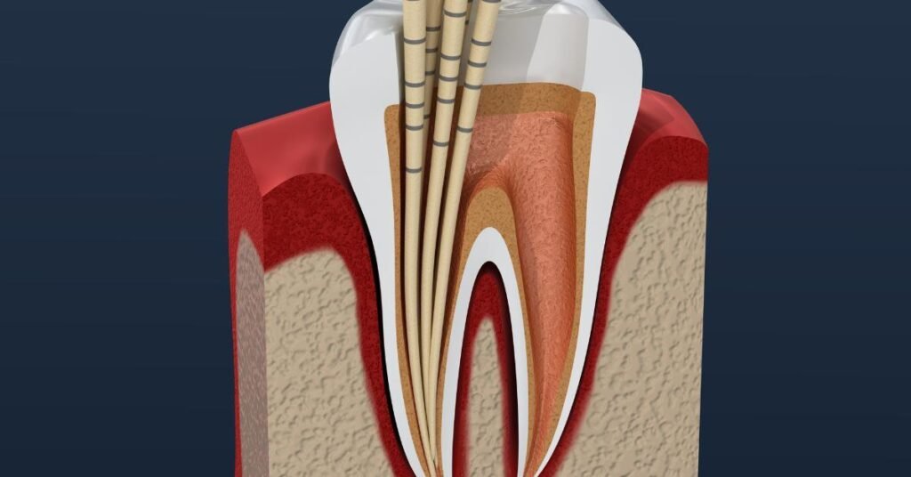 endodontic specialists