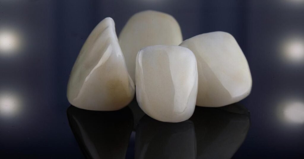 cosmetic dental crowns