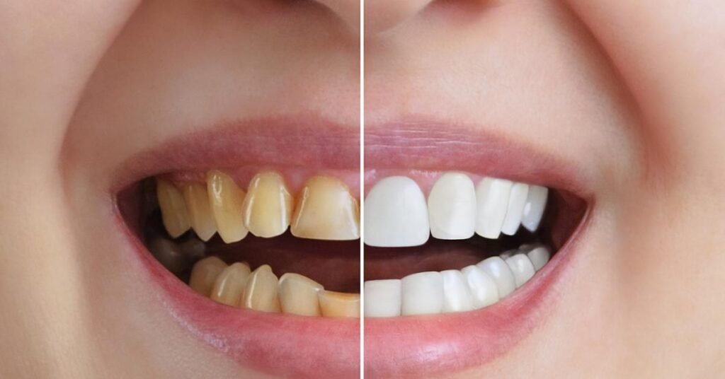 how long does a dental crown take