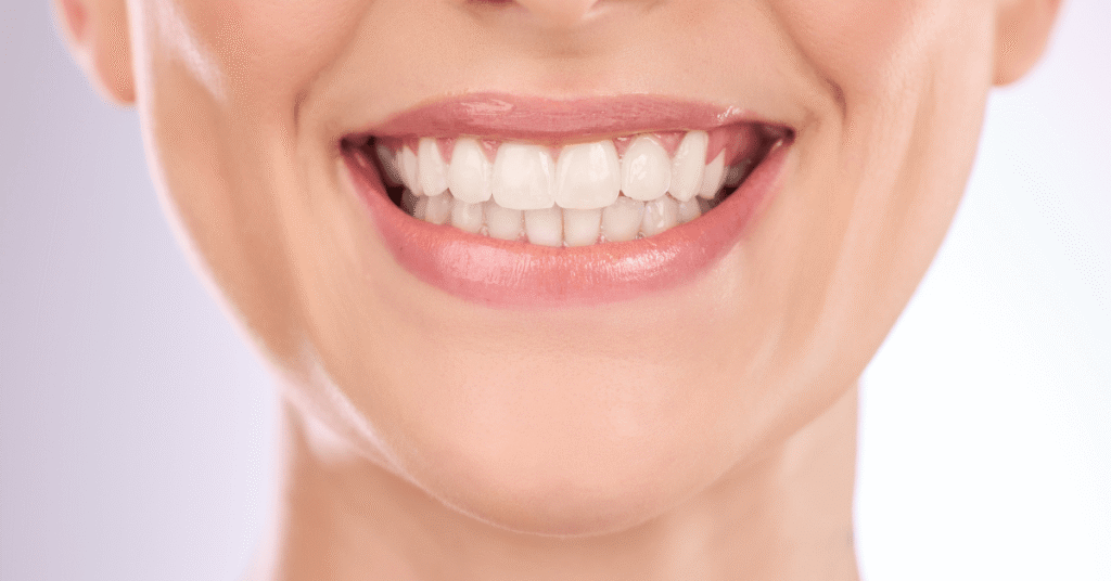 Teeth whitening machine