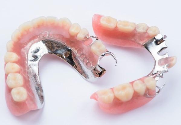 Before and After Partial Dentures