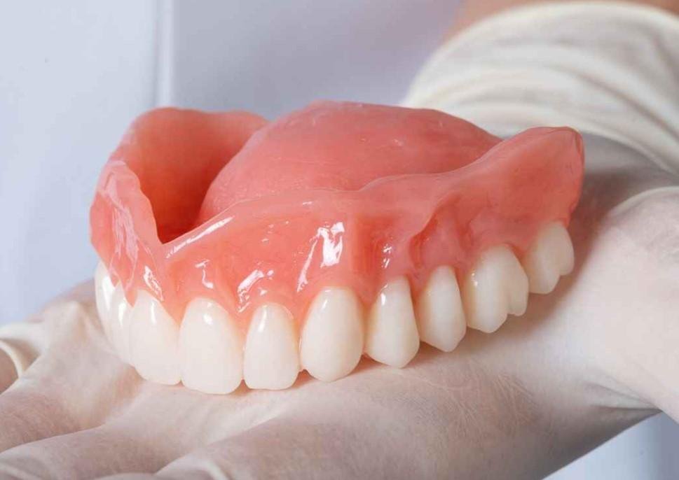 Full Mouth Extraction Immediate Dentures Pictures