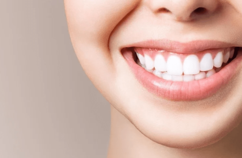 Does charcoal whiten teeth?