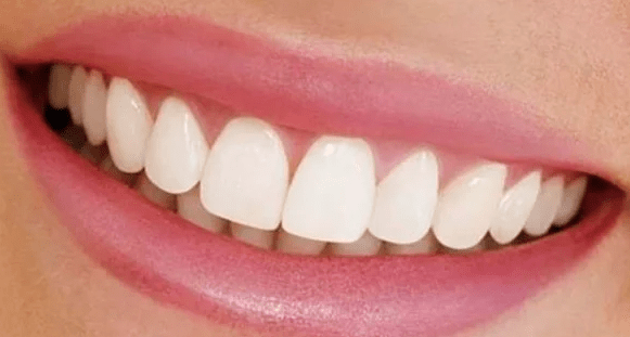 Immediate dentures near me