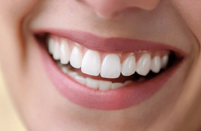 How much does it cost to whiten teeth?