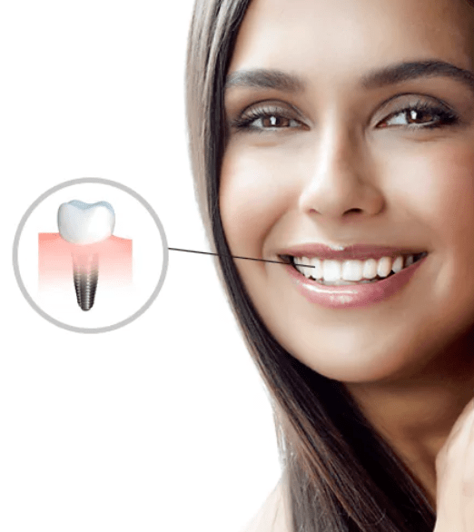 Single tooth denture