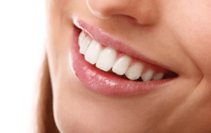 ODSP dental implants