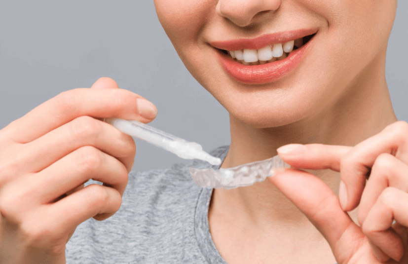 Teeth whitening gel