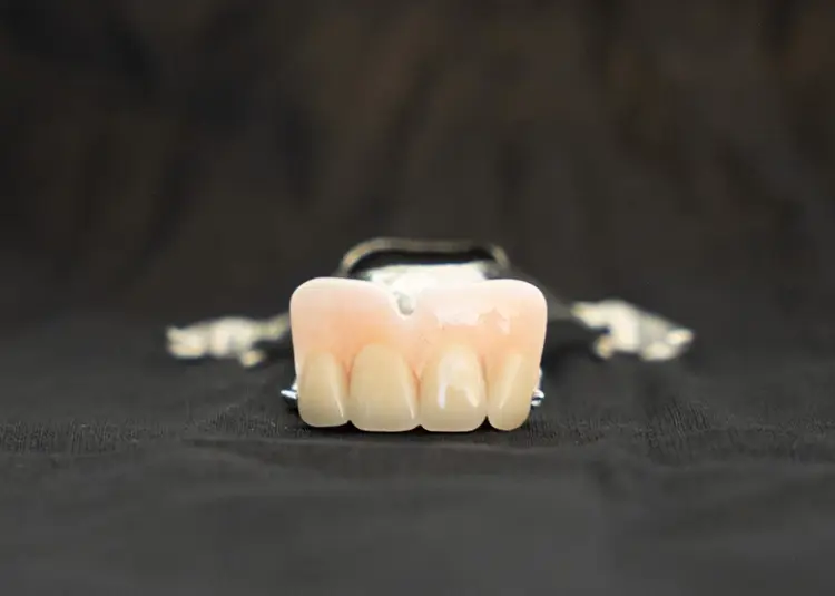 Front teeth partial dentures pictures