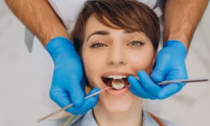 How long does a root canal last?